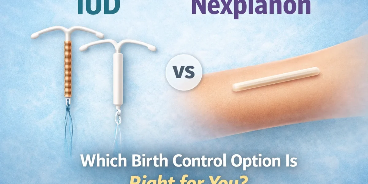 iud or nexplanon